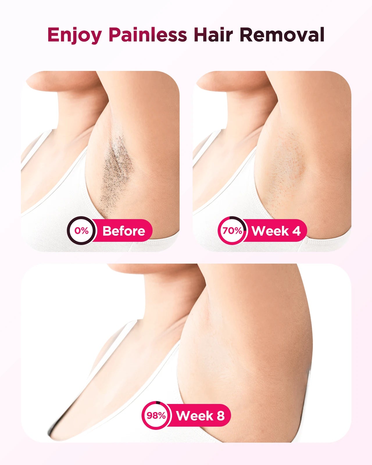 990000 Flash Laser Epilator IPL Hair Removal for Men and Women Body Bikini Facial Permanant Painless IPL Hair Remover Machine